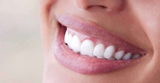 La sonrisa de tus sueños: ¡Implantes dentales gratuitos!